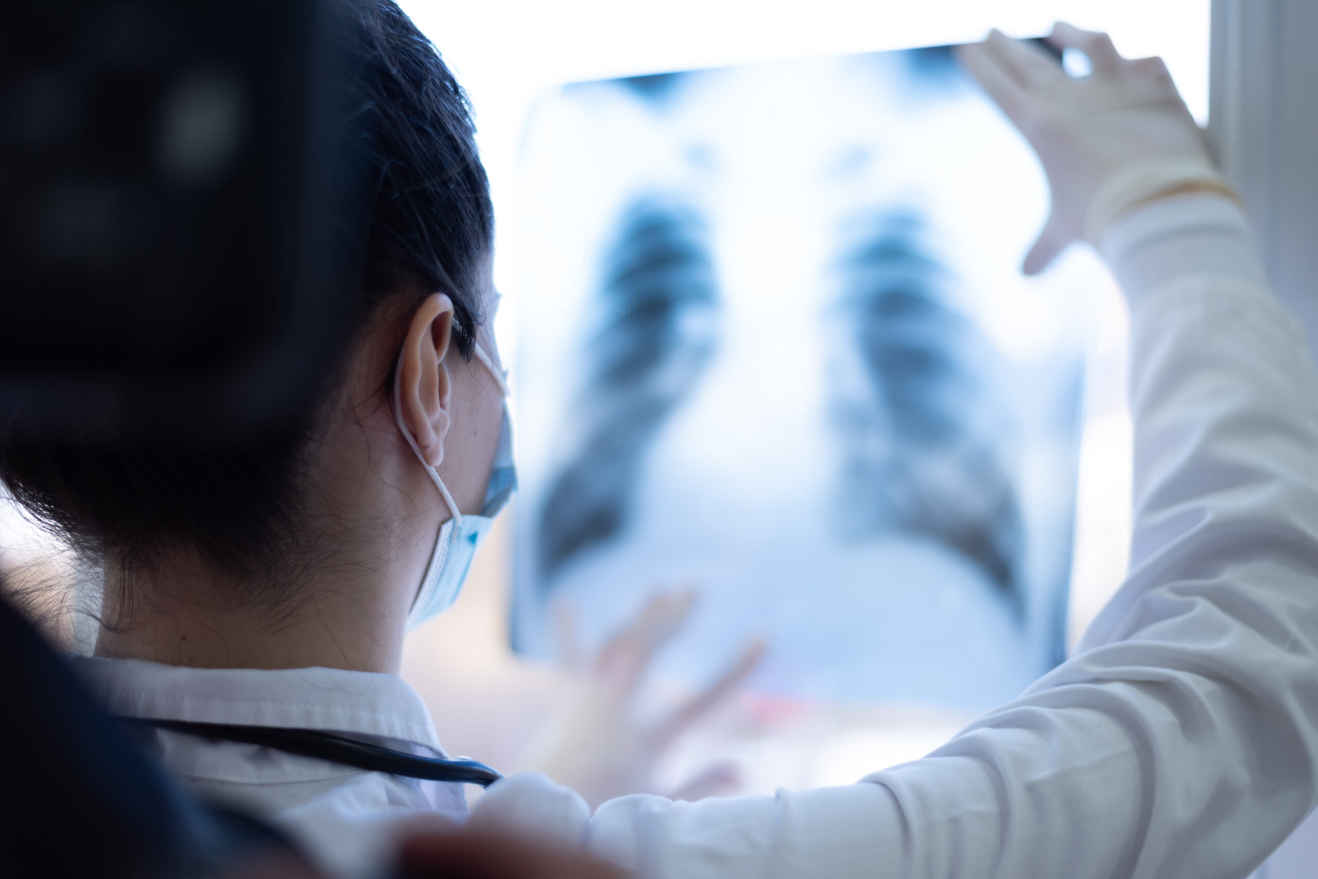 A medical professional wearing a mask examines a chest X-ray image, holding it up to the light for closer inspection.